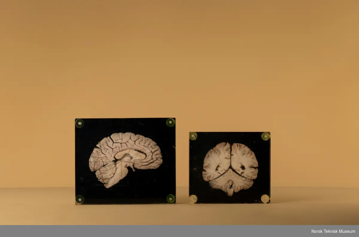 Tverrsnitt av hjerne i glasslignende materiale med påført tekst som viser til forskjellige hjernedelene med svart bakgrunn.
