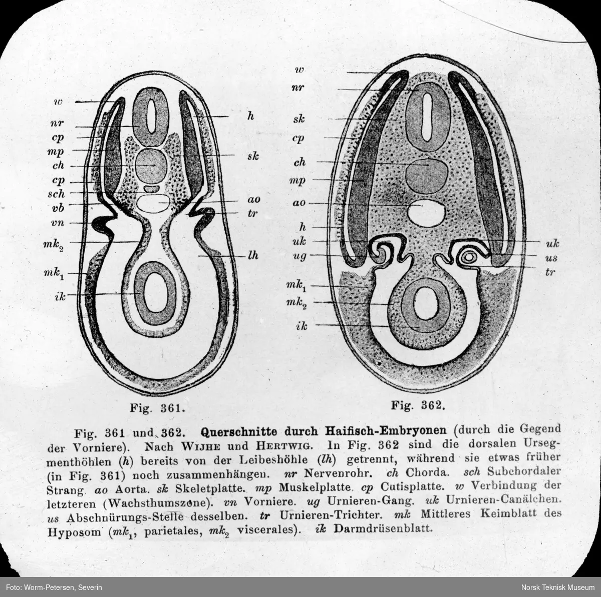 Figurer anatomi, gjennomskåret haifisk-embryo