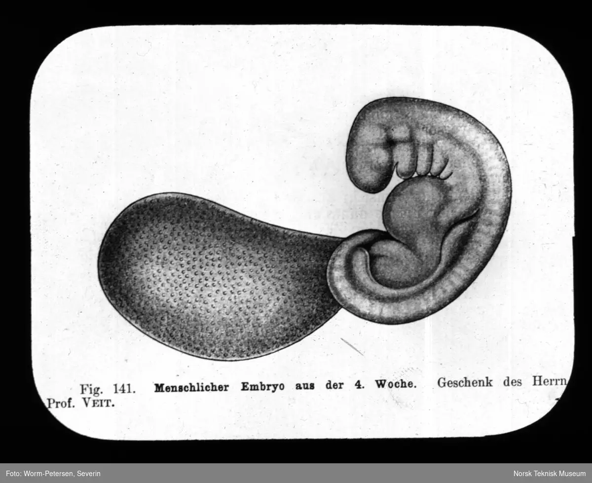 Et menneskelig embryo i 4 uke