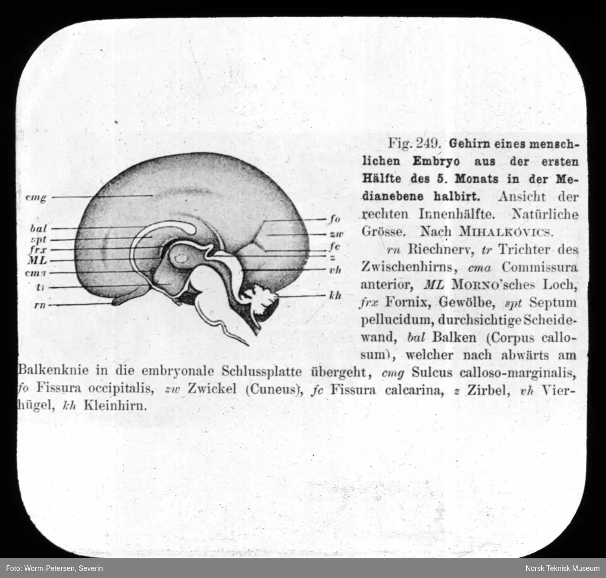 Hjernen til et menneskelig embryo