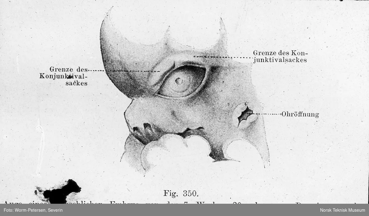 Figur anatomi, øyet til foster ca 7 uker