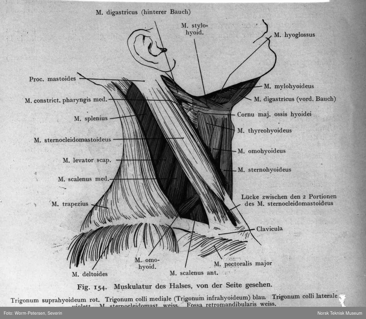 Anatomisk illustrasjon, halsmuskler - Norsk Teknisk Museum / DigitaltMuseum