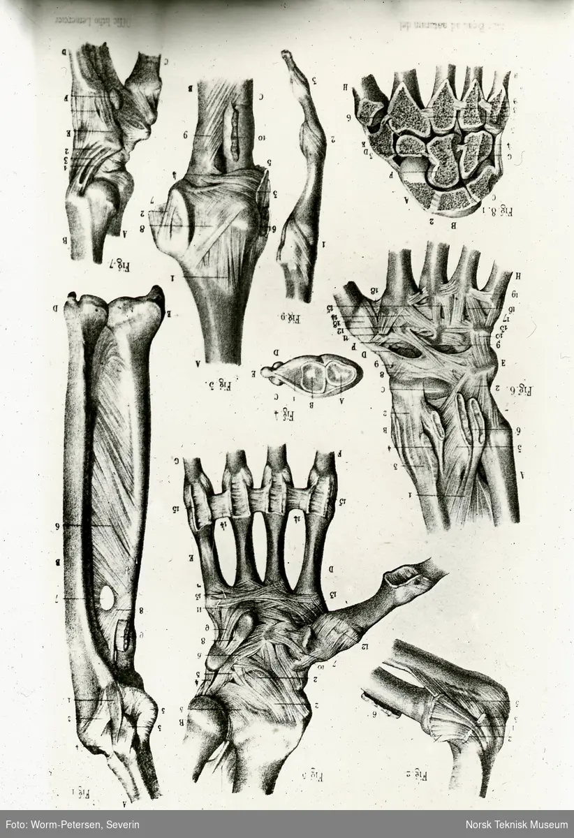 Hånden, forskjellige anatomiske tegninger (umontert glass-dias)